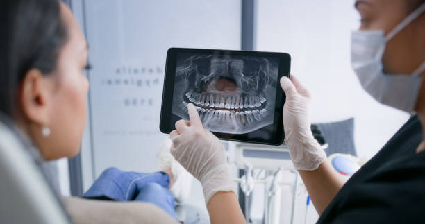 Licensed Teeth Whitening service in Nacogdoches, TX - Smile Center Dentistry
